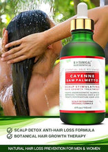 Load image into Gallery viewer, Botanical Hair Growth Lab - Anti-Hair Loss Scalp Treatment for Hair Growth and Hair Thinning Prevention - Essential Hair Rescue - Hair Loss Prevention for Men and Women.