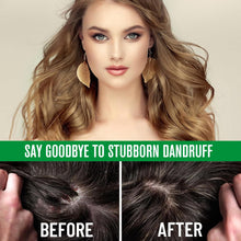 Load image into Gallery viewer, Batana Oil Hair Growth Spray - Natural Hair Growth Serum with Batana Oil, Castor Oil, Rosemary Oil, Rice Water, Biotin - Nurturing Scalp and Effective Hair Thickening for Women and Men 2 Fl Oz.
