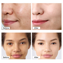 Load image into Gallery viewer, Retinol Cream for Face – Anti-Aging, Wrinkle Reduction, Moisturizing &amp; Brightening with 3% Active Retinol, Hyaluronic Acid, Vitamin E &amp; Green Tea – 1.70 fl oz
